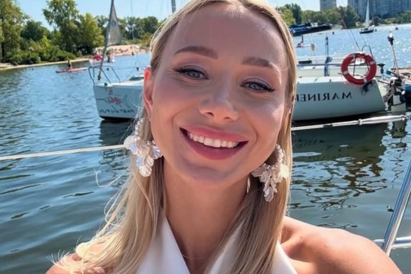 Репяхова поділилася історією невдалої пластики та показала фото “до” і “після”